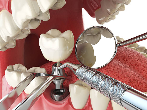 Best Emergency Treatment for Jaw Pain or Injury in Kenyon, MN